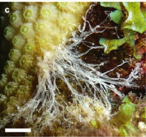 mesenterial filaments.png